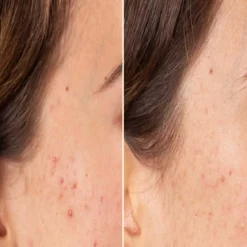 Azelaic Radiance Face Serum