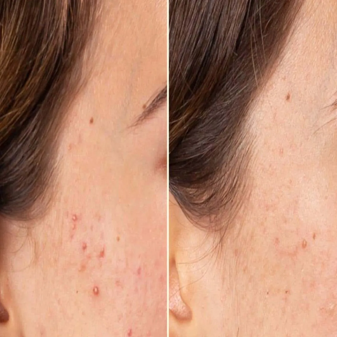 Azelaic Radiance Face Serum