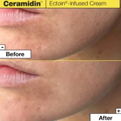 Ceramidinâ„¢ Ectoin-Infused Cream