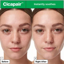Cicapair Intensive Soothing Repair Serum