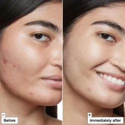 Cicapair™ Tiger Grass Camo Drops SPF 35