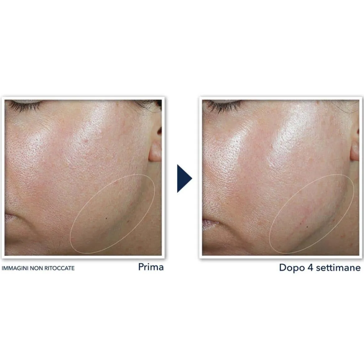 Contour Cream crema Viso