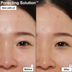 Dermask Porecting Solution