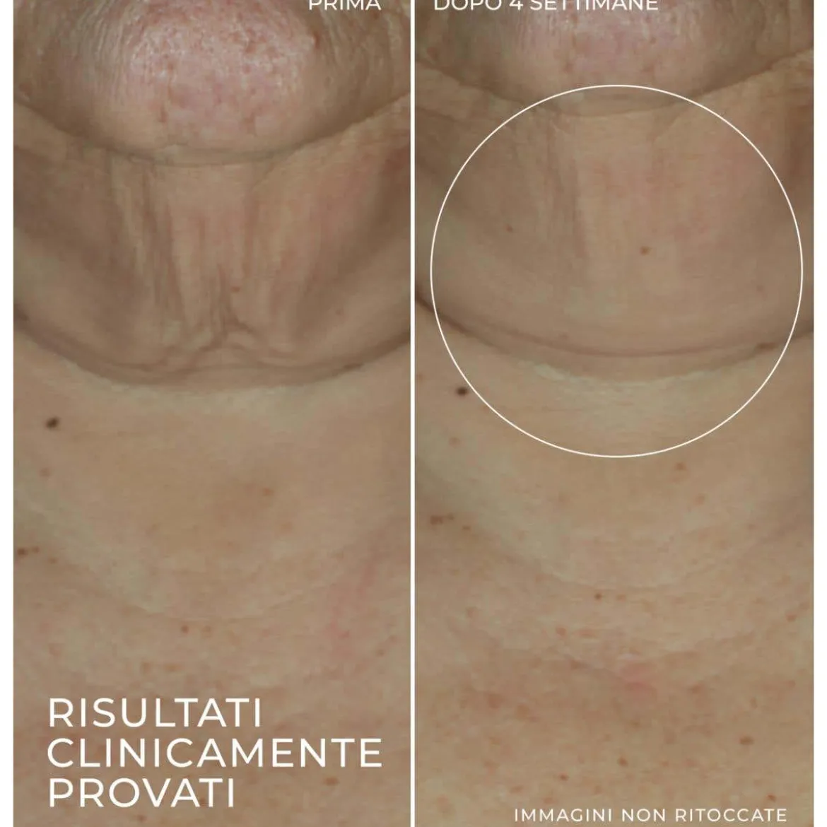 Derm Correxion Firming Serum Stick