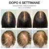Estremirimedi Siero 6 Trattamento Fortificante scalpo & capelli
