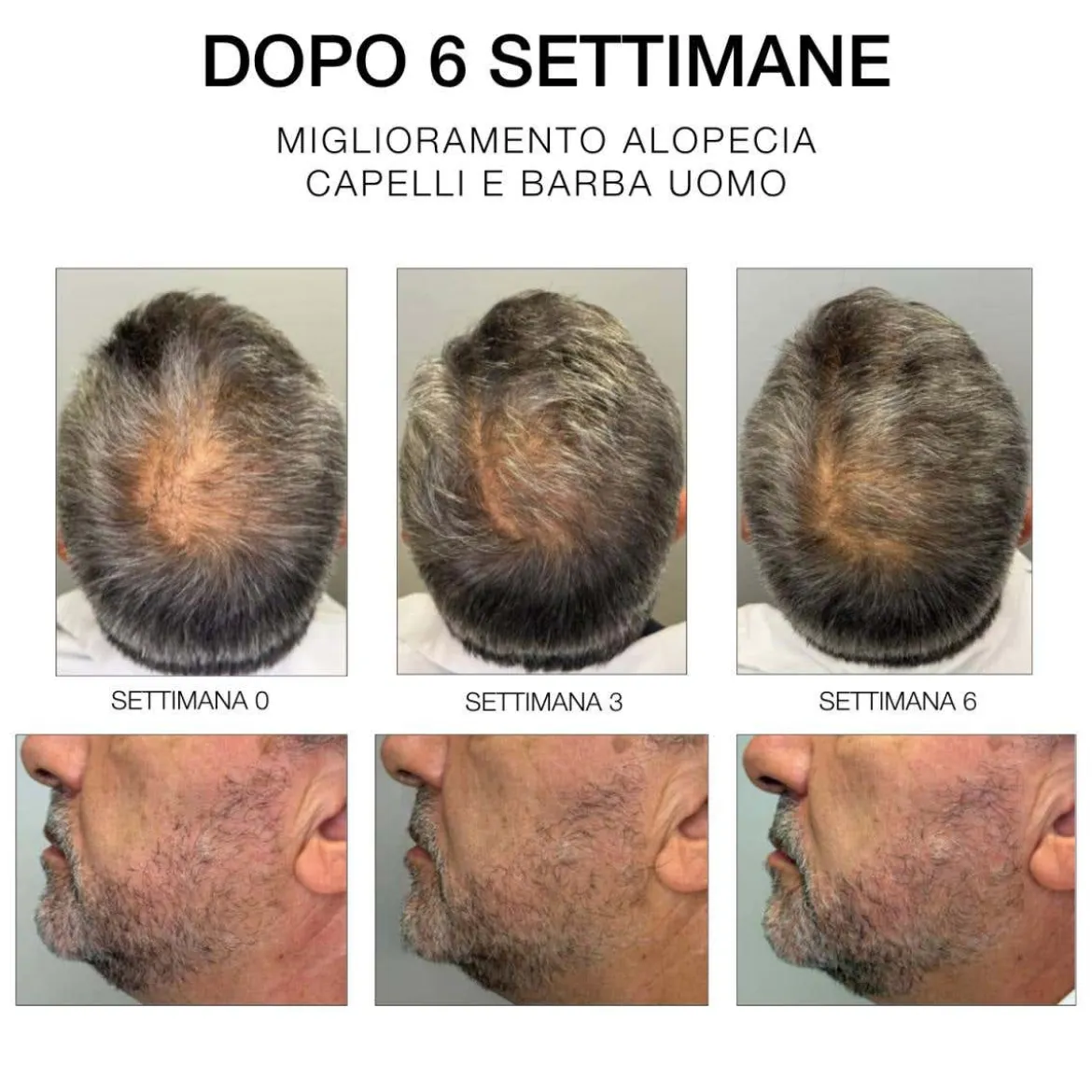 Estremirimedi Siero 6 Trattamento Fortificante scalpo & capelli