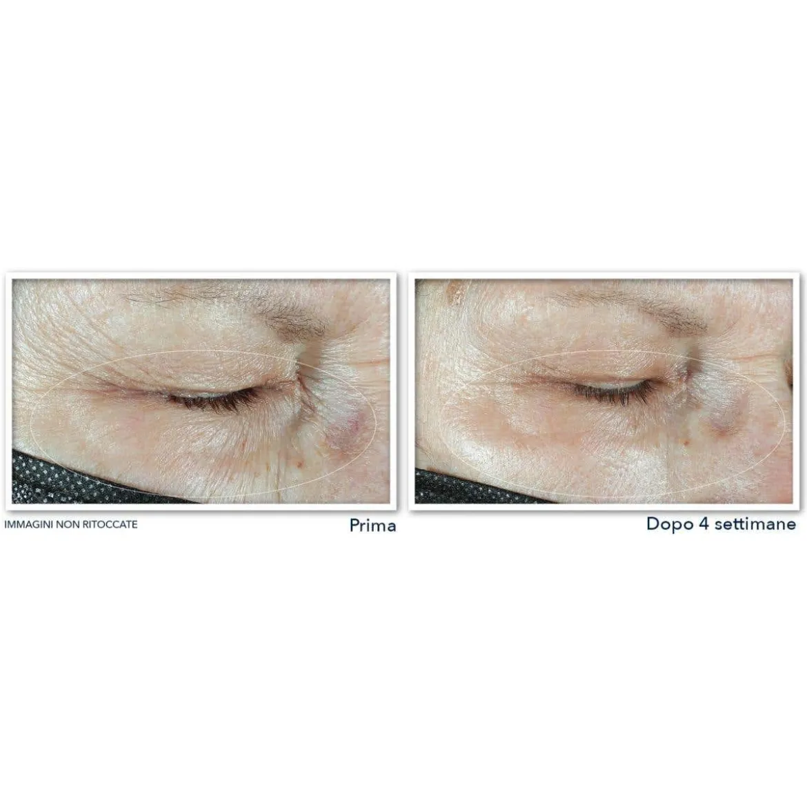 Hydrate + Plump Crema Occhi