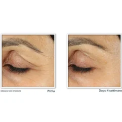 Line Smoothing Crema Occhi